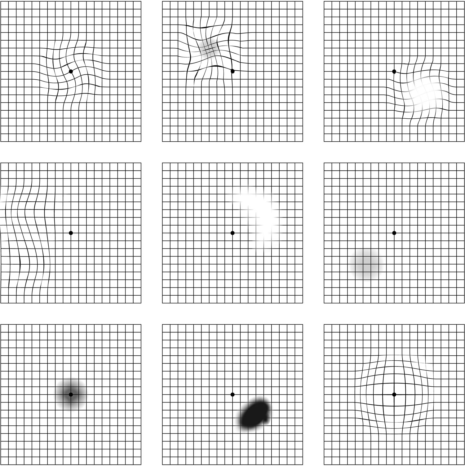 Amsler Grid Test Distortions